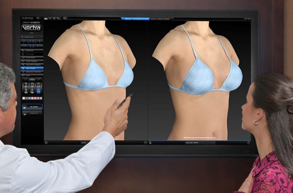 Vectra imaging example