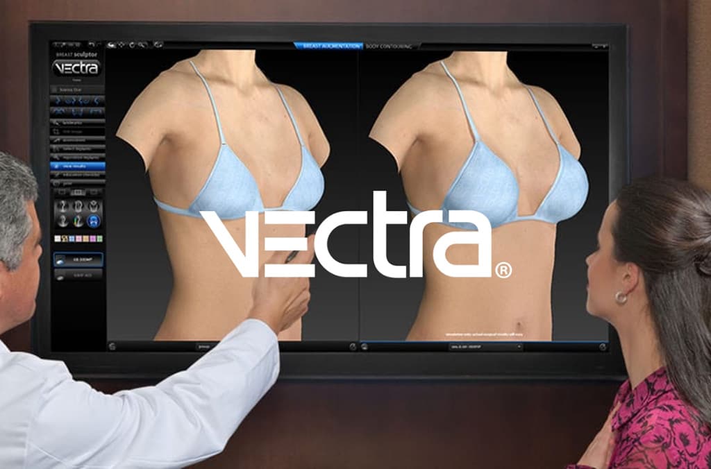 Vectra imaing example