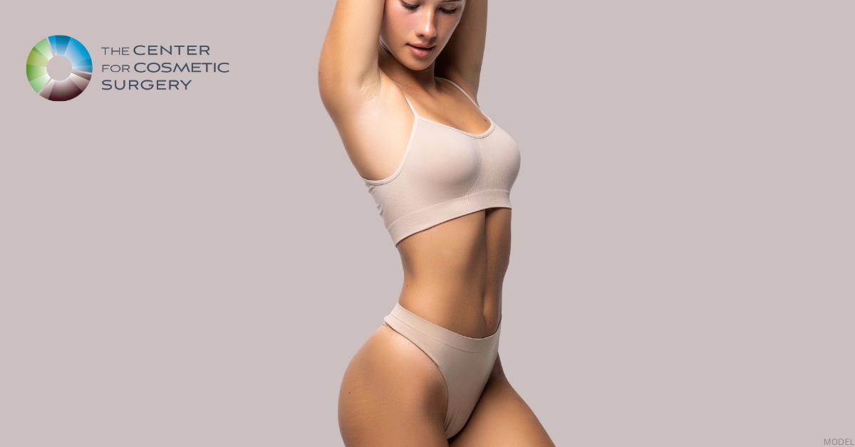 Woman showing liposuction results (model)