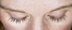 Woman's eyelashes after LATISSE® Eyelash Growth Treatment