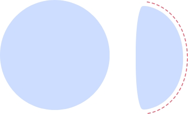 Illustration of a round breast implant